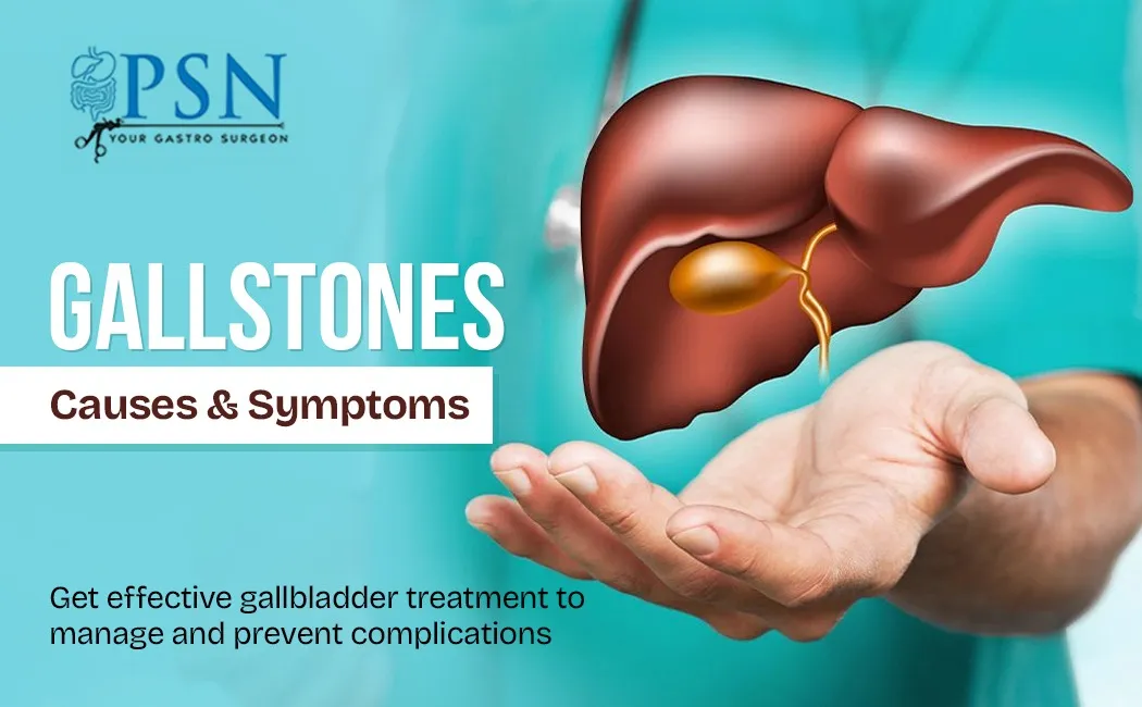 Gallstones: Causes & Symptoms Get effective gallbladder treatment to manage and prevent complications