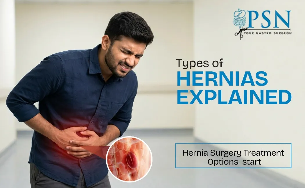 Types of Hernias Explained Hernia Surgery Treatment Options