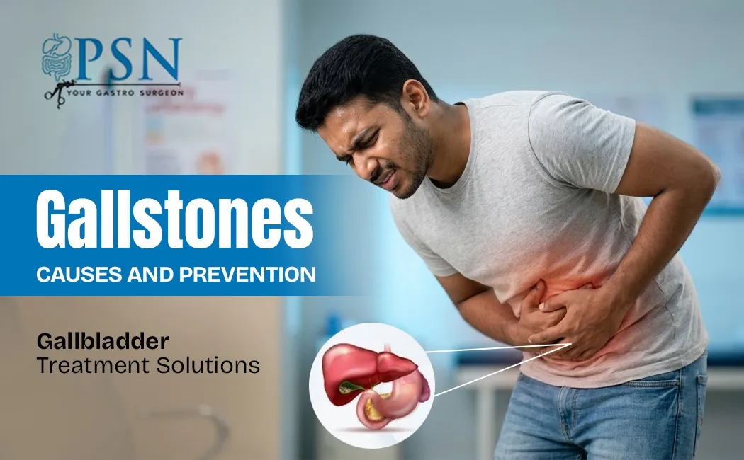 Gallstones Causes and Prevention Gallbladder Treatment Solutions