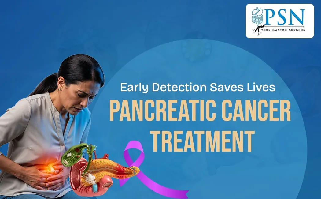 Early Detection Saves Lives Pancreatic Cancer Treatment