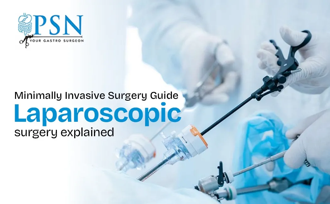 Laparoscopic Surgery
