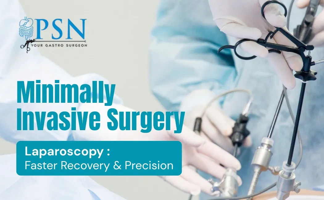 Laparoscopic Surgery