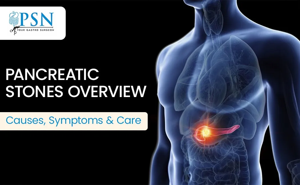 Pancreatic Treatment