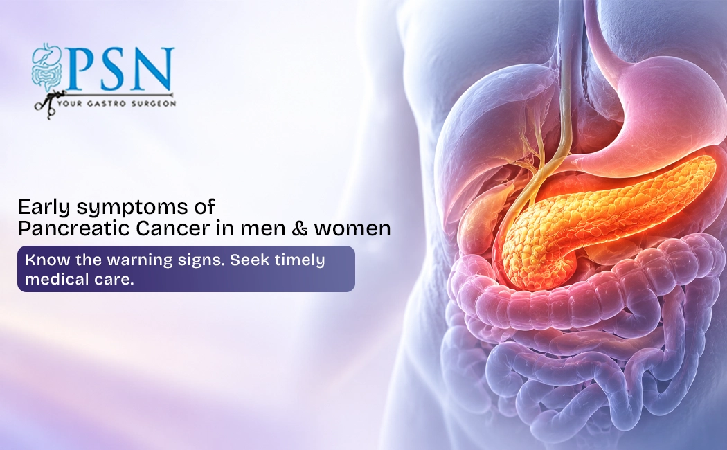 Pancreatic Cancer Treatment in Chennai